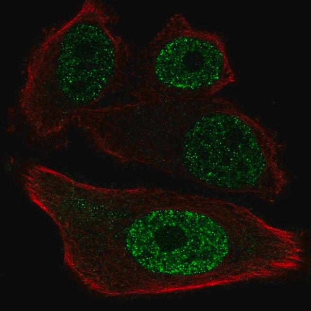 Anti-ETV1 antibody produced in rabbit