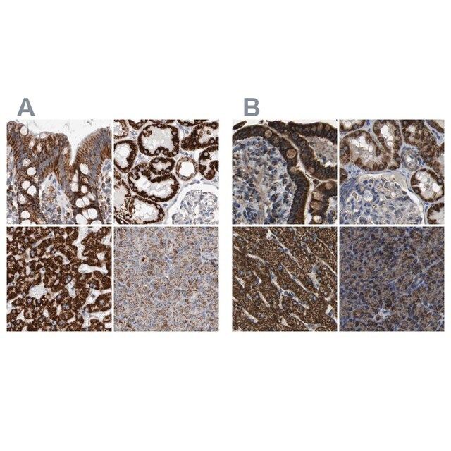 Anti-ETFA antibody produced in rabbit