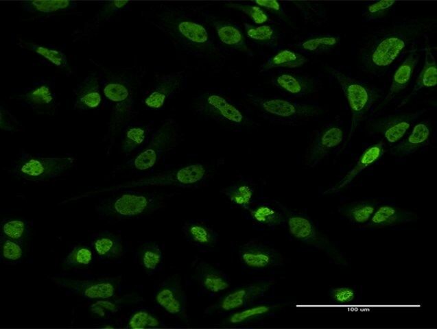 Anti-EWSR1 antibody produced in mouse