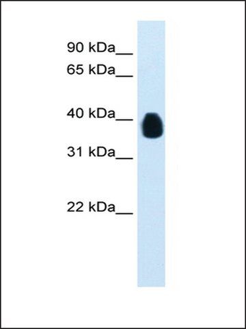 Anti-ETV7 antibody produced in rabbit