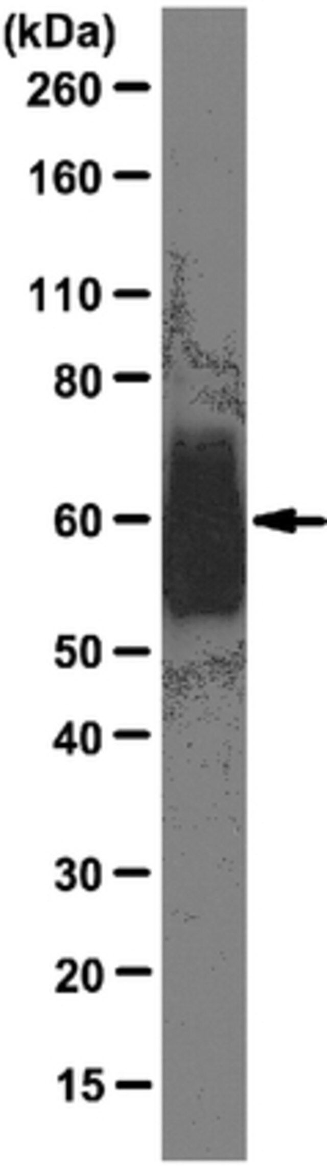 Anti-Excitatory amino acid transporter 2 Antibody, clone G6