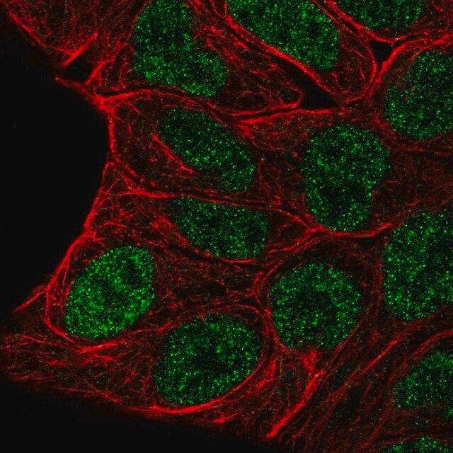 Anti-EVX1 antibody produced in rabbit