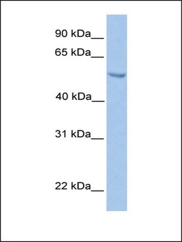 Anti-ETV5 antibody produced in rabbit