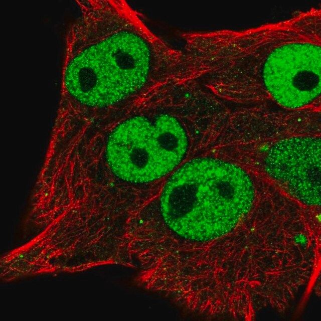 Anti-ETV5 antibody produced in rabbit