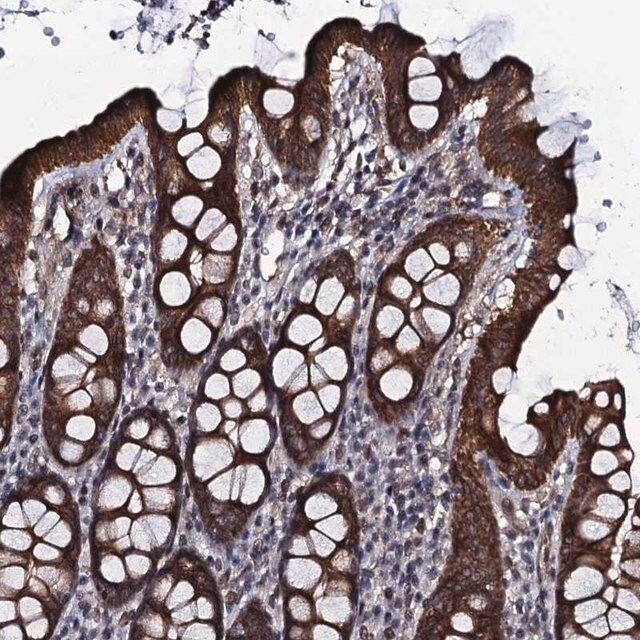 Anti-EVX2 antibody produced in rabbit