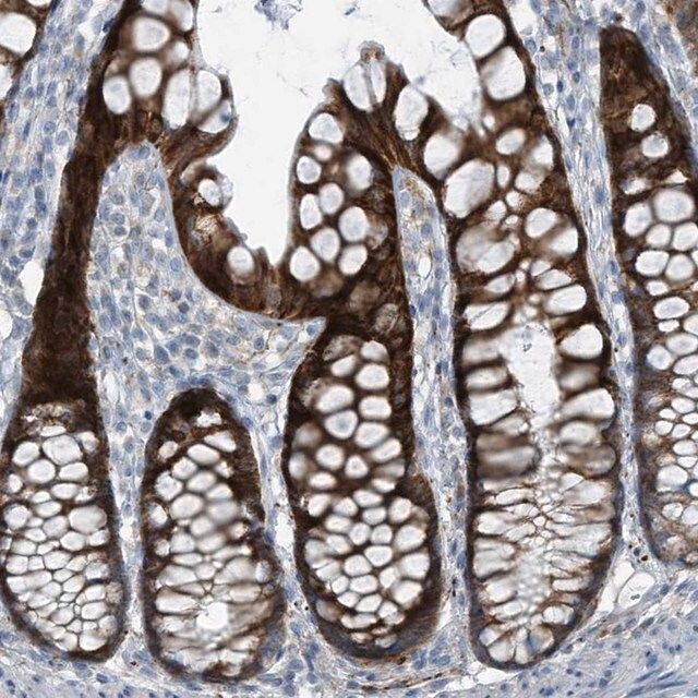 Anti-FAM162A antibody produced in rabbit