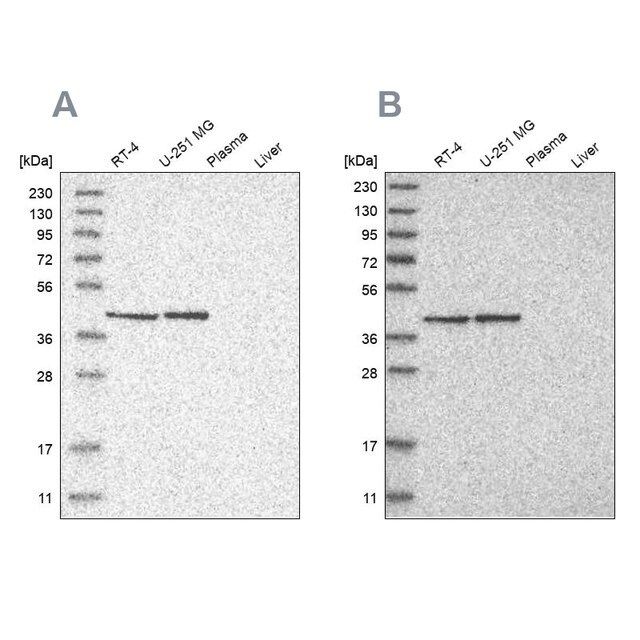 Anti-ERAL1 antibody produced in rabbit