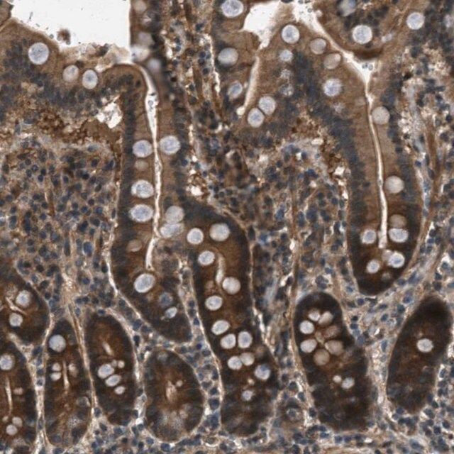 Anti-EPSTI1 antibody produced in rabbit