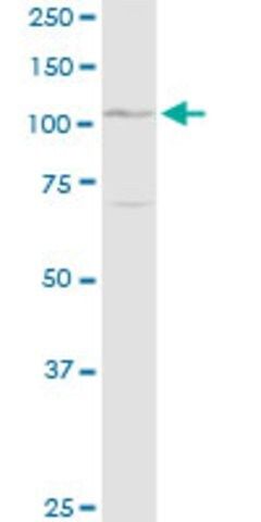Anti-DSG1 antibody produced in rabbit
