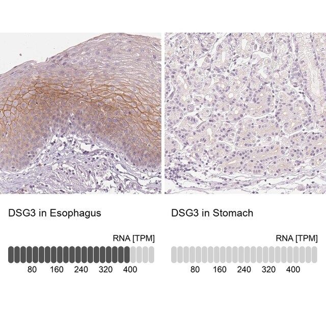 Anti-DSG3 antibody produced in rabbit