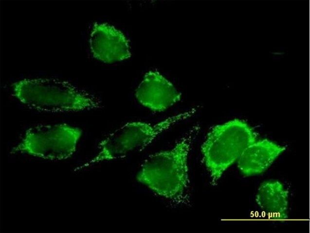 Anti-DLAT antibody produced in mouse