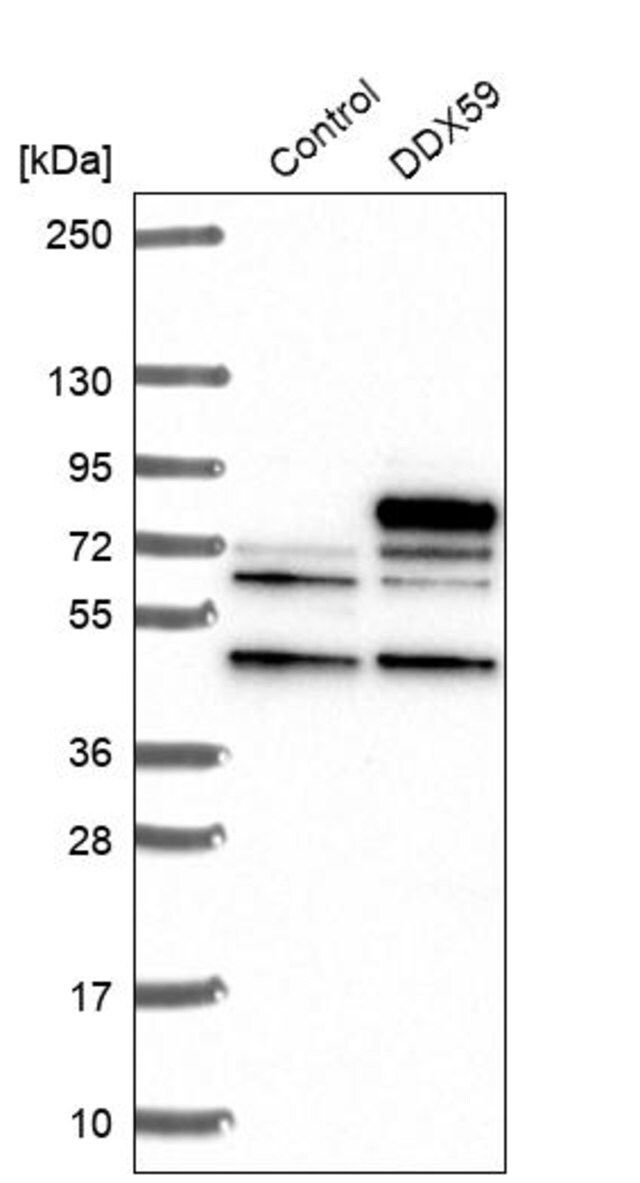 Anti-DDX59 antibody produced in rabbit