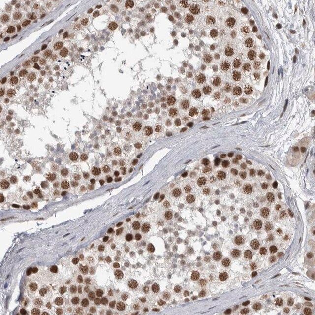 Anti-DDX42 antibody produced in rabbit