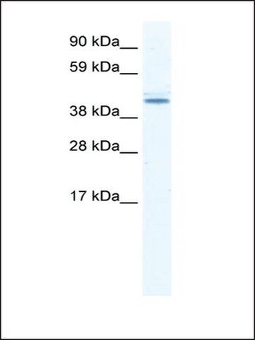 Anti-DDX49 antibody produced in rabbit