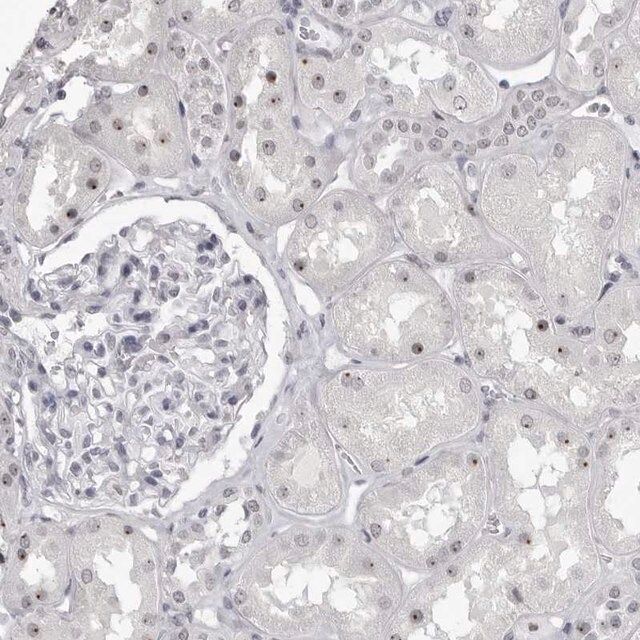 Anti-DDX54 antibody produced in rabbit
