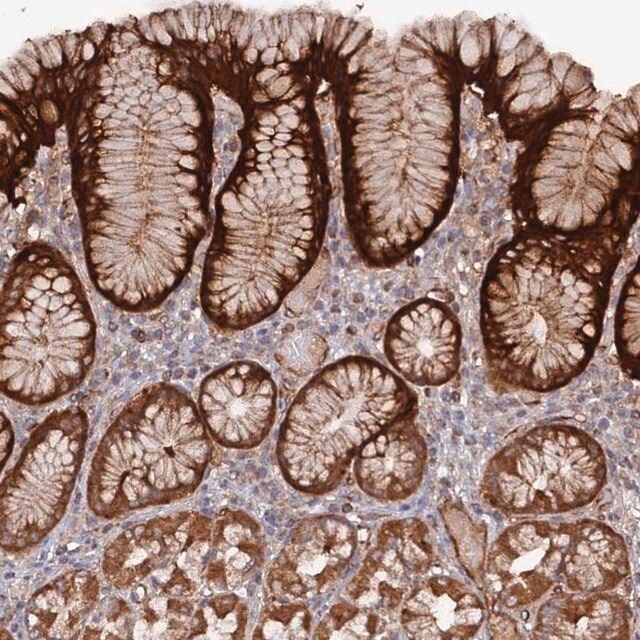 Anti-DDX60 antibody produced in rabbit