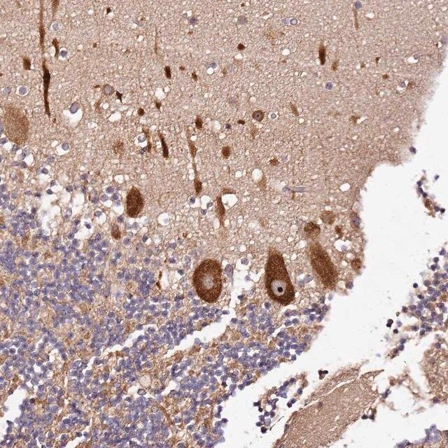Anti-DDX27 antibody produced in rabbit