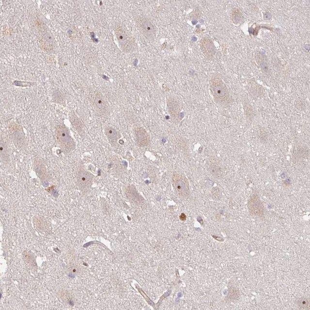 Anti-DIMT1 antibody produced in rabbit