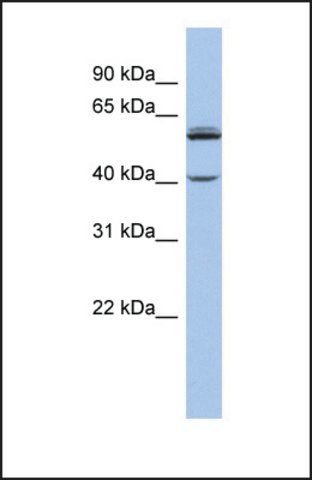 Anti-CYP4V2 antibody produced in rabbit