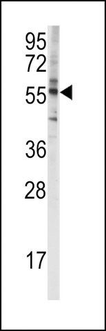 ANTI-CYP4F8(C-TERMINAL) antibody produced in rabbit