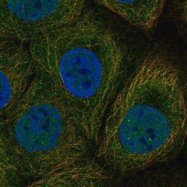 Anti-DAPL1 antibody produced in rabbit