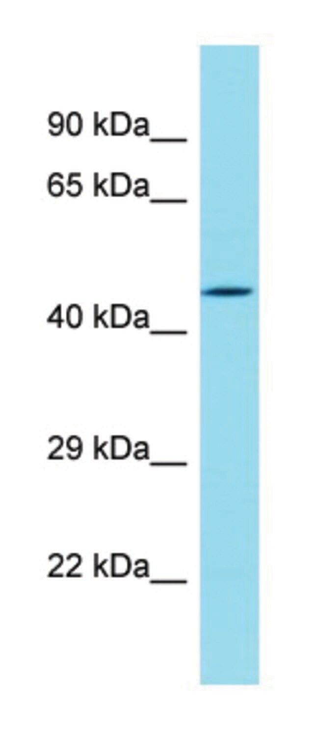 Anti-DBF4B (N-terminal) antibody produced in rabbit