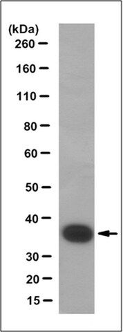 Anti-CRALBP Antibody, clone 3H9.1