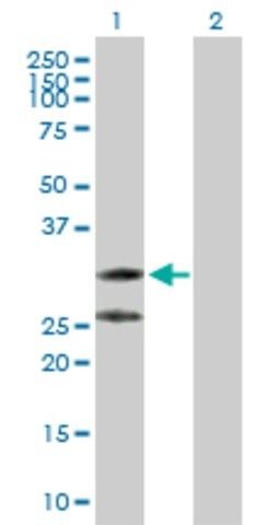 Anti-C1QTNF2 antibody produced in rabbit
