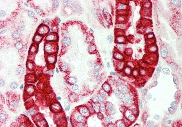 Anti-CRAT antibody produced in rabbit