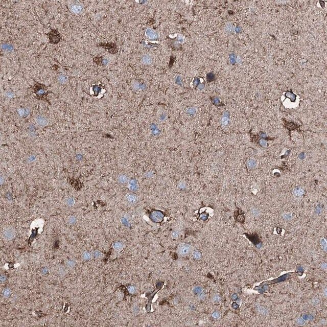 Anti-C1QTNF4 antibody produced in rabbit