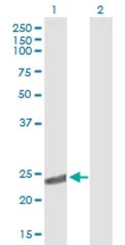 Anti-CRYBA2 antibody produced in mouse