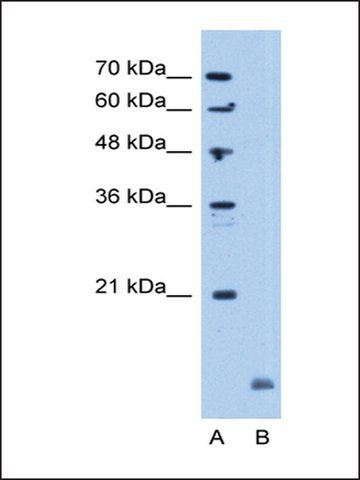 Anti-CRYAB antibody produced in rabbit