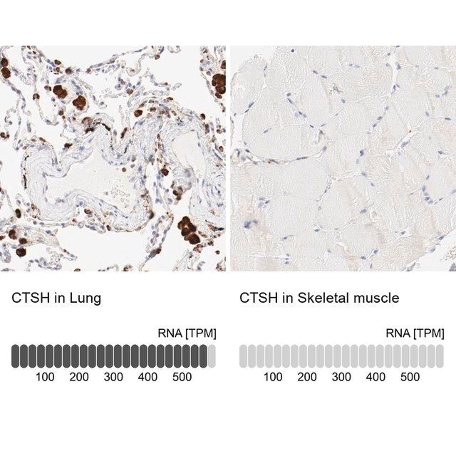Anti-CTSH antibody produced in rabbit