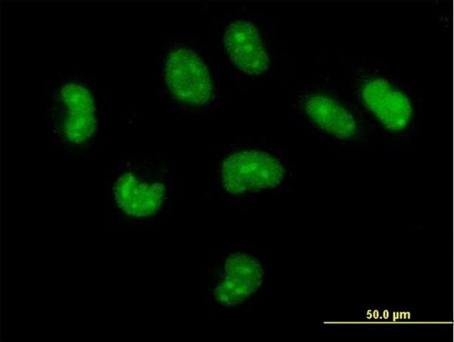 Anti-CUTC antibody produced in mouse