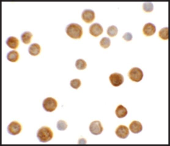Anti-C2orf40 antibody produced in rabbit