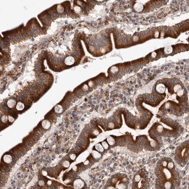 Anti-C4orf3 antibody produced in rabbit