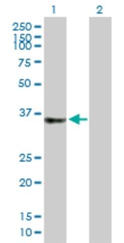 Anti-C2ORF43 antibody produced in mouse