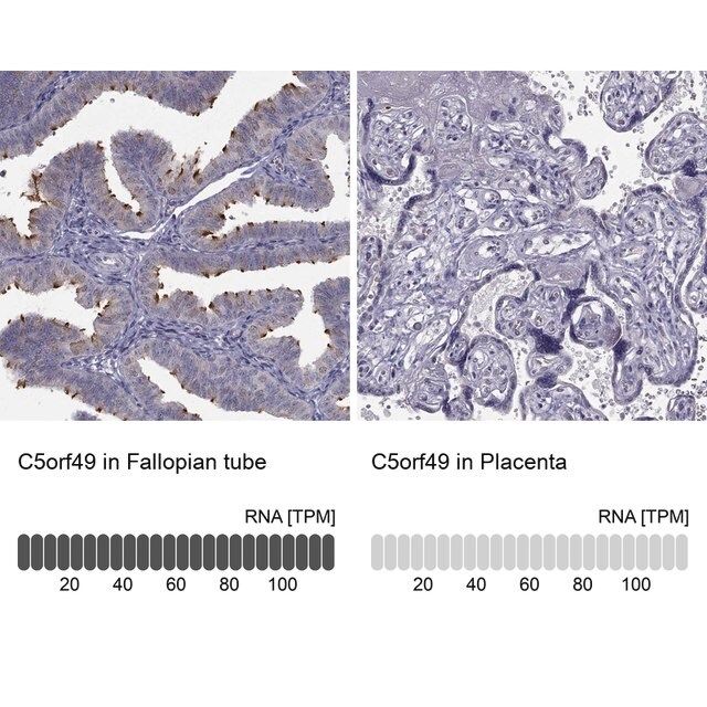 Anti-C5ORF49 antibody produced in rabbit