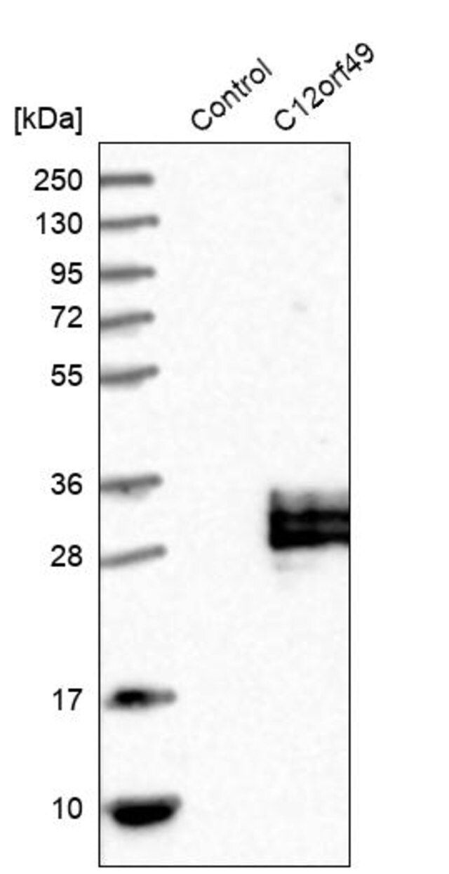 Anti-C12orf49 antibody produced in rabbit