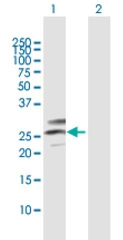 Anti-C12orf49 antibody produced in mouse