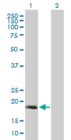 Anti-C17ORF49 antibody produced in mouse