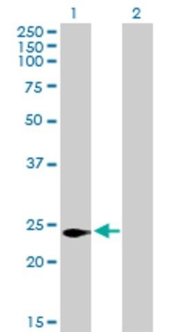 Anti-C16ORF5 antibody produced in mouse