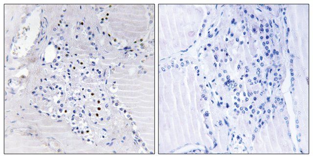 Anti-C9ORF89 antibody produced in rabbit