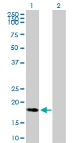 Anti-C9ORF89 antibody produced in mouse