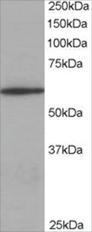 Anti-Coronin 1/TACO antibody produced in goat
