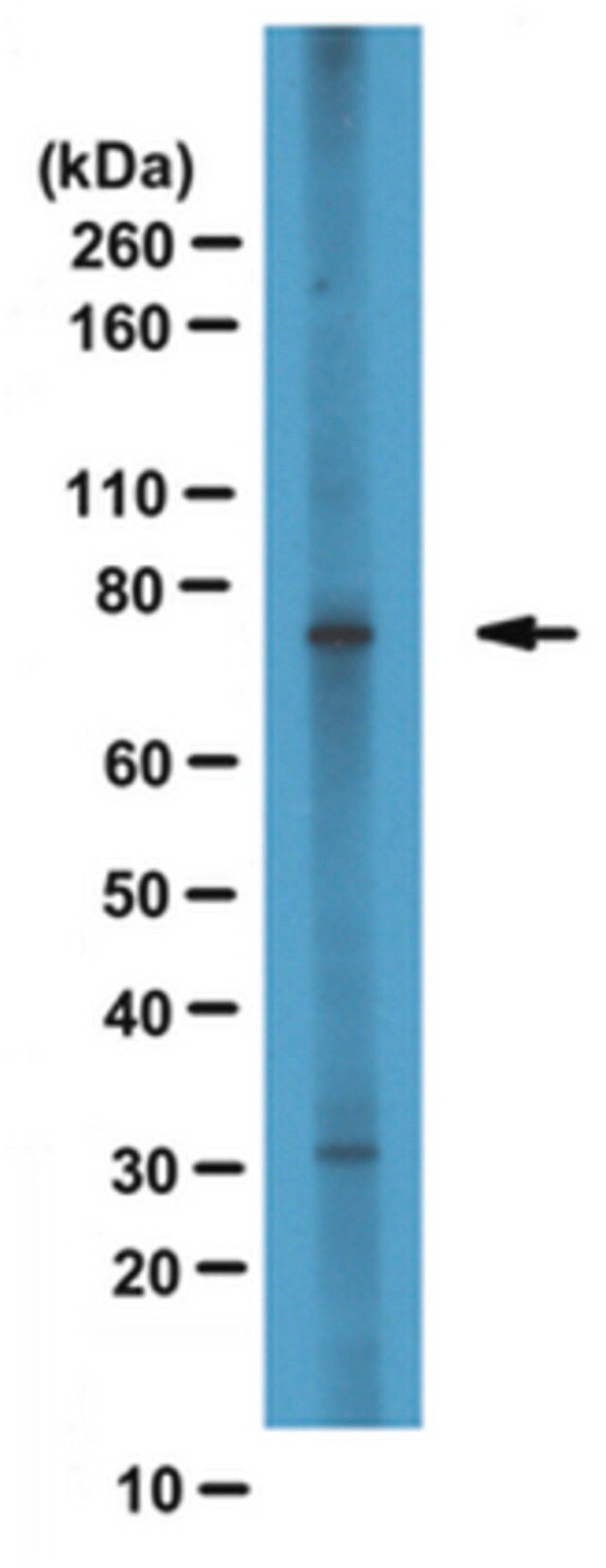 Anti-CPT1A Antibody