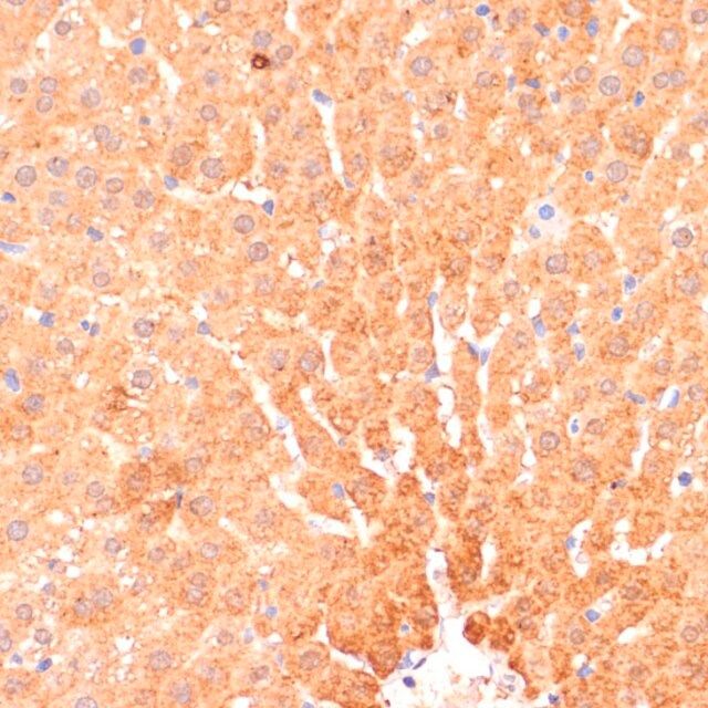 Anti-CPT1B antibody produced in rabbit