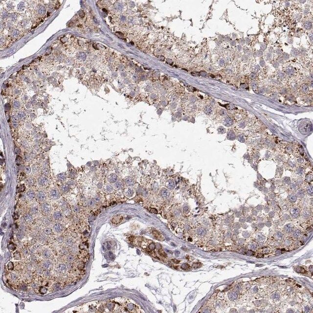 Anti-CMTM3 antibody produced in rabbit