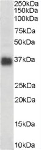 Anti-Clusterin/APOJ (AB1) antibody produced in goat