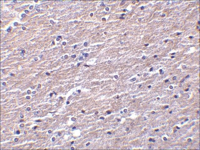 Anti-Clusterin antibody produced in rabbit
